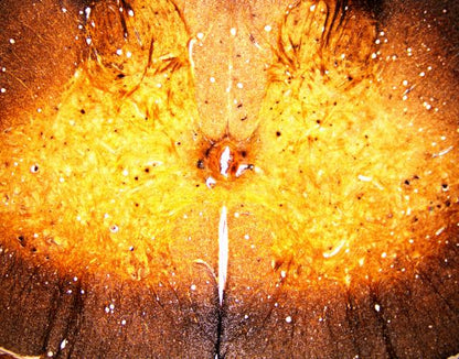 Bresser accessoires f5986001