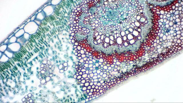 Bresser mikrokular full hd eyepiece camera